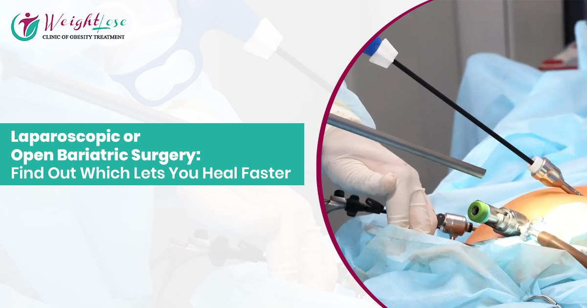 Laparoscopic or Open Bariatric Surgery: Find Out Which Lets You Heal Faster